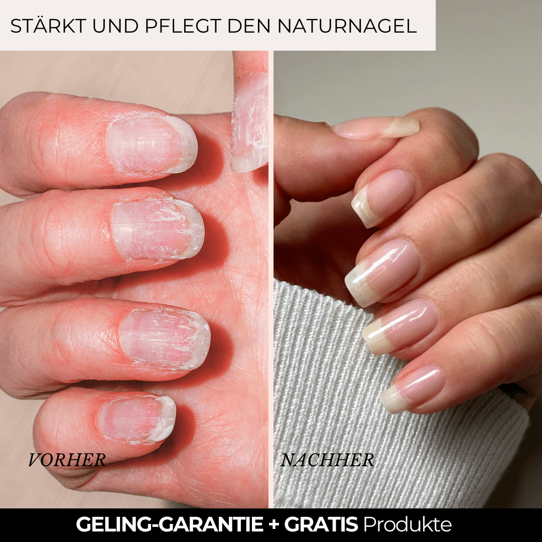 Magic Base – ALLIN Frühlings-Starterset